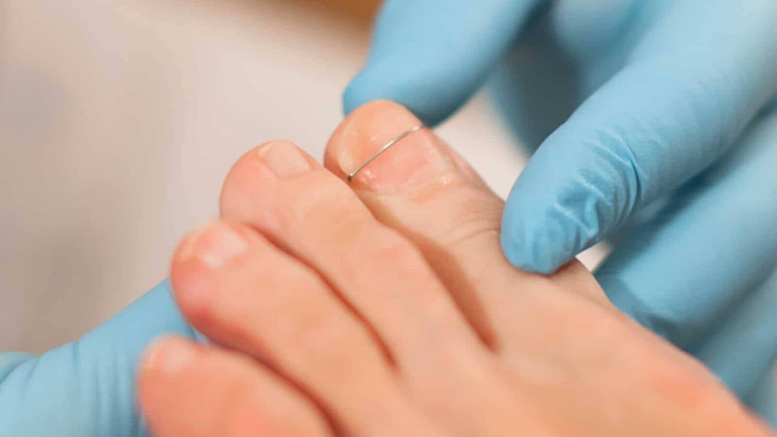 Nagelbeugel van camathe